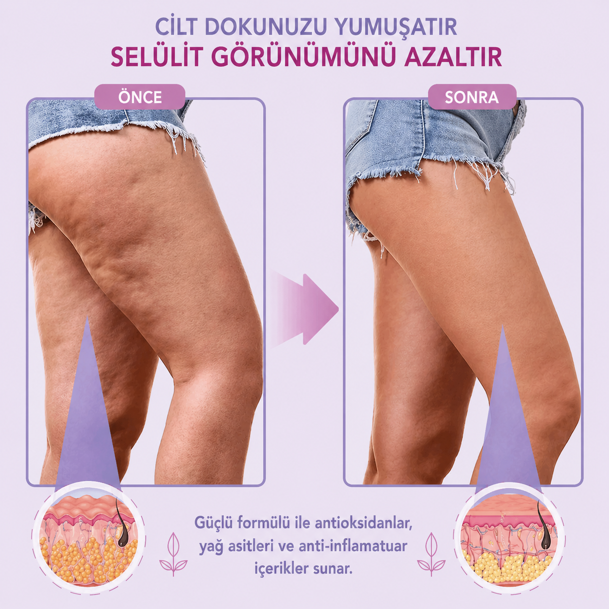 Anında  Toparlayıcı Selülit Bantı